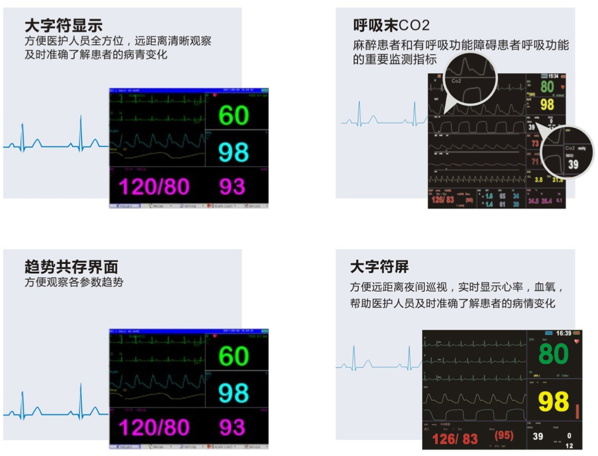 多參數(shù)監(jiān)護(hù)儀M-9000E-產(chǎn)品細(xì)節(jié)展示